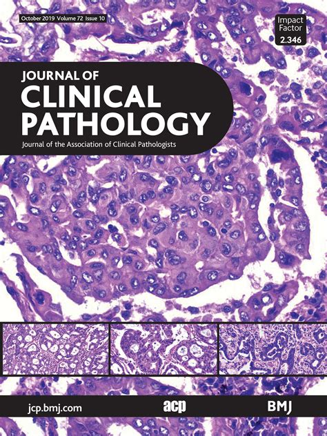 Developing a pan-cancer research autopsy programme | Journal of