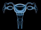 Womb Cancer Misdiagnosis Claims - BBK Solicitors