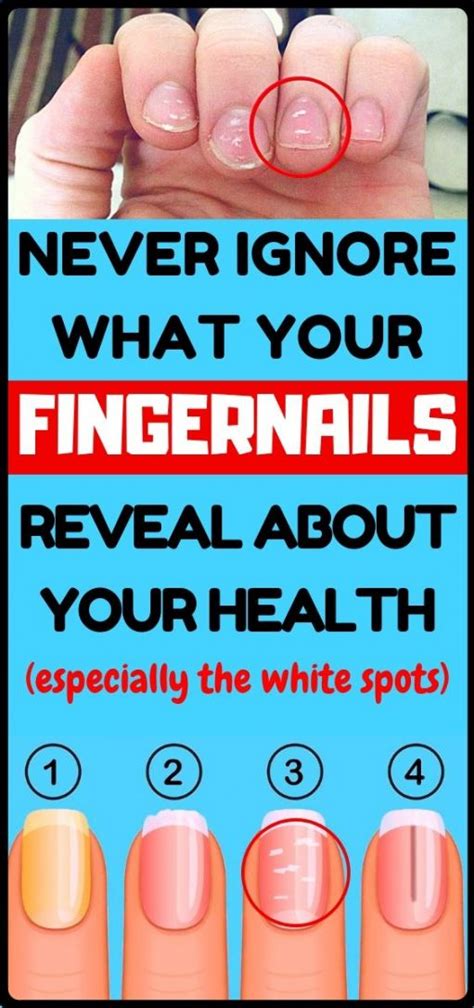 What Your Fingernails Say About Your Health Healthy Lifestyle