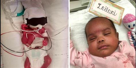 ‘miracle Baby Born At Just 22 Weeks Goes Home After 4 Months In Nicu