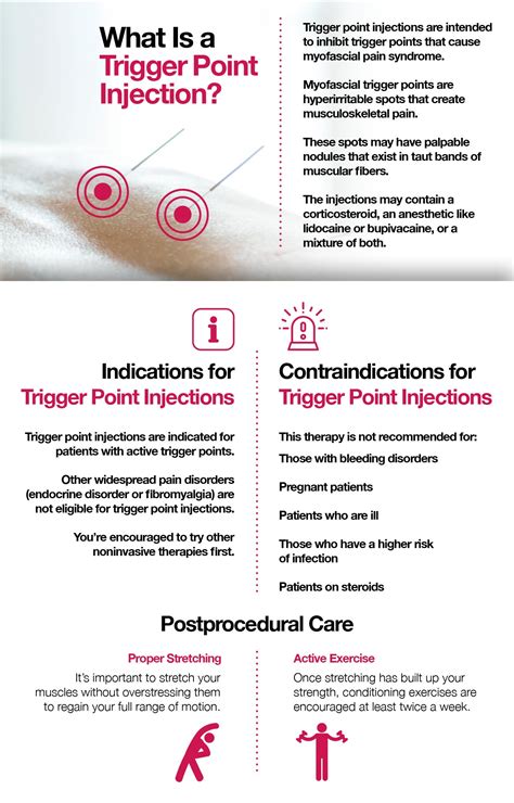 Trigger Point Injections What They Are When Needed And How Performed