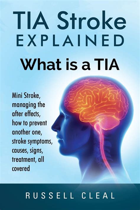 Mini Stroke Tia Stroke Causes Symptoms Signs Treatmen