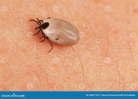 Tick On Human Skin Stock Photo Image Of Dangerous Arachnid 25057752