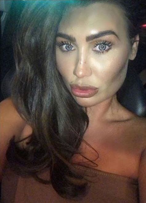 Lauren Goodger Removes Face Fillers After Surgeon Brands Her Manly And Vows Not To Have More