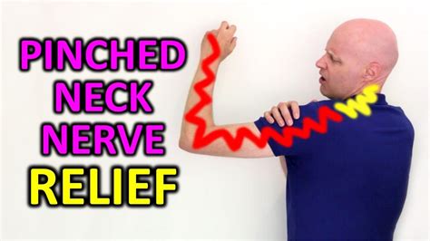The Best Exercise To Fix A Pinched Nerve Causing Neck And Arm Pain Youtube