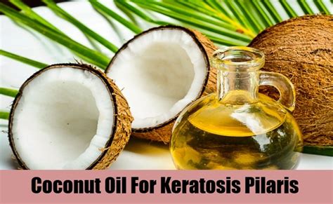 5 Effective Treatments For Keratosis Pilaris How To Treat Keratosis