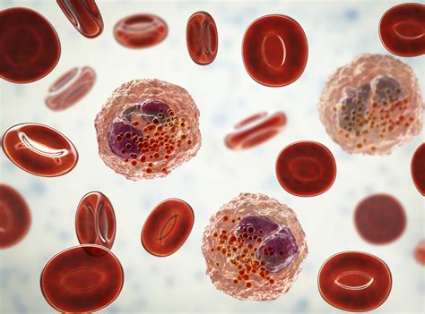 Blood Disorders Medicover Genetics