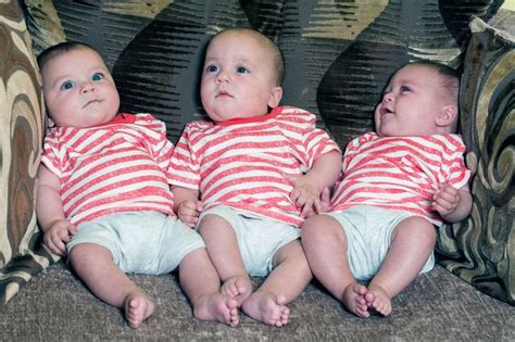 Meet The One In Two Million Triplets Where Twins Share Same Amniotic