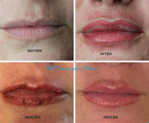 Semi Permanent Makeup Lips Healing Process Saubhaya Makeup