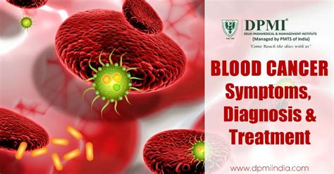 Blood Cancer Symptoms Diagnosis And Treatment