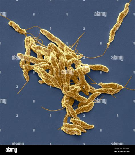 La bacteria Campylobacter jejuni Color análisis micrografía de