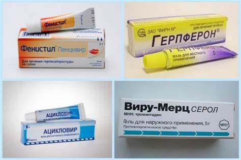 Как выглядит герпес на ноге Как выглядит герпес на ноге