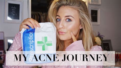 MY ACNE JOURNEY ADVICE THAT CHANGED MY LIFE WHAT DID DIDN T WORK YouTube