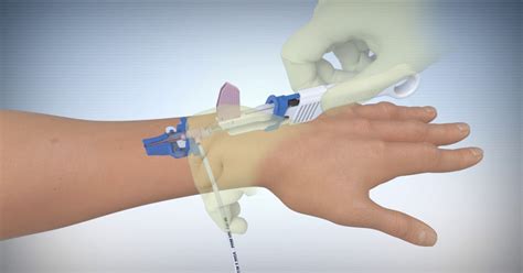 Intravenous Access Devices Used To Draw Blood And To Deliver