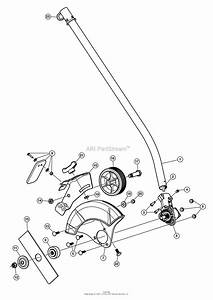 Knee Replacement Diagram