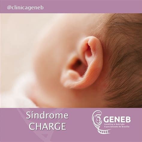 Síndrome Charge Clínica Geneb