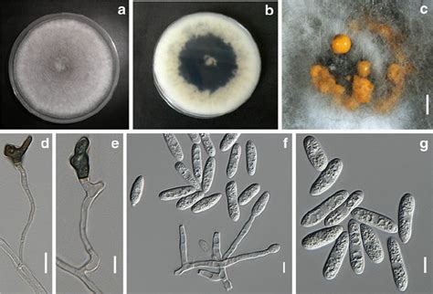 Morphology Of Colletotrichum Endophytica Holotype Mflu 130418 A B