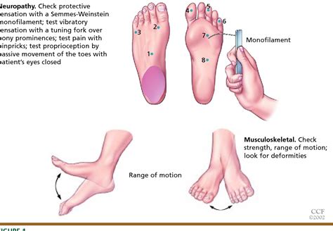 A Practical Guide For Examining And Treating The Diabetic Foot