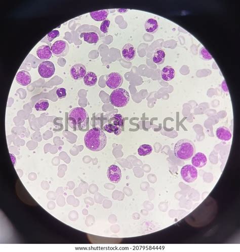 Leukocytes Under Microscope 100x Magnification Stock Photo 2079584449
