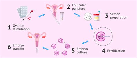 Invitro Fertilization Process