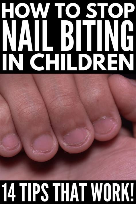 How To Get Kids To Stop Biting Their Nails 14 Tips For Parents Nail