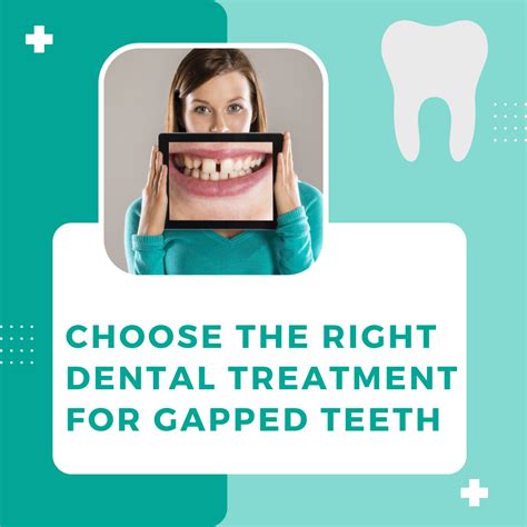 Choose The Right Dental Treatment For Gapped Teeth Cumbria Smiles