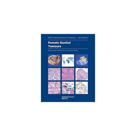 Who Classification Of Tumours Female Genital Tumours Librer A M Dica