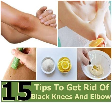 How To Get Rid Of Dark Elbows And Knees Naturally Dark Elbows How To