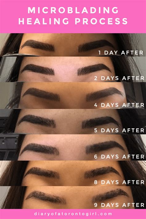My Microblading Experience Day By Day Healing Photos Microblading Eyebrows Permanent