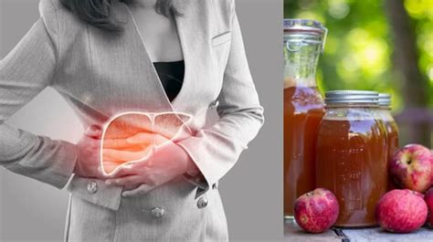 Apple Cider Vinegar For Fatty Liver 3 Effective Home Remedies For A