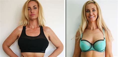Josie Gibson Plastic Surgery Before And After Photos