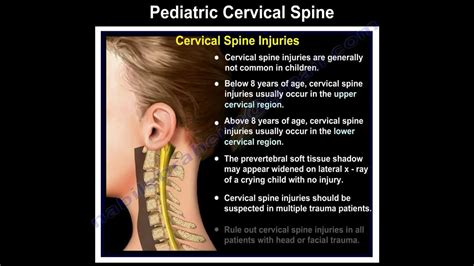 Pediatric Cervical Spine Injuries Everything You Need To Know Dr Nabil Ebraheim Youtube