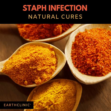 Fighting A Staph Infection Effectively With Home Remedies Earth Clinic®