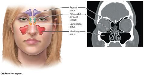 Acute Sinusitis Causes Symptoms Antibiotics And Treatment