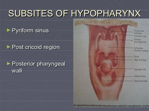 Anatomy Of Hypopharynx Anatomy Drawing Diagram