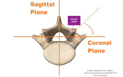 Orientation Of Your Lower Lumbar Joints And The Implication For Back