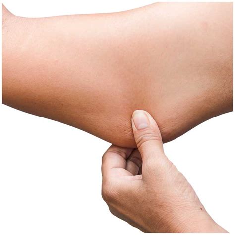 Brachioplasty Arm Lift Partners In Plastic Surgery