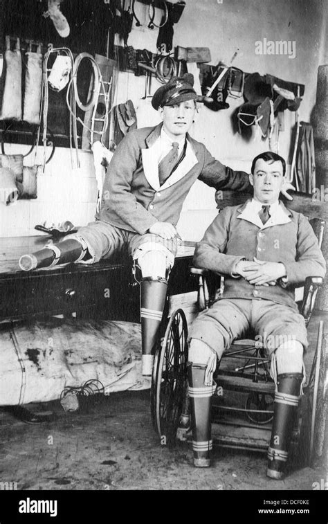Two Amputee Soldiers In A False Limb Workshop During The Great War