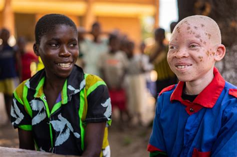 Making Education Safe For Children With Albinism In Malawi United