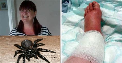 Warning Graphic Content Woman Hospitalized Twice In A Year After