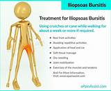 Exercises Hip Bursitis Images