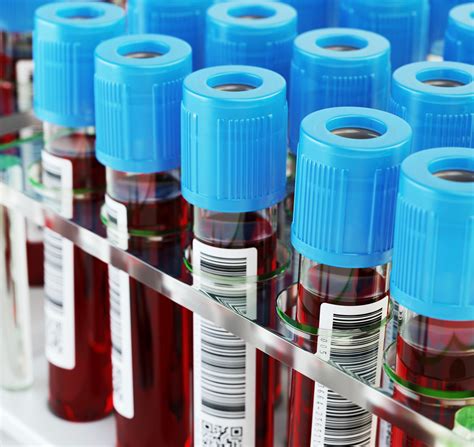 Non Invasive Blood Test Can Detect Cancer Four Years Before