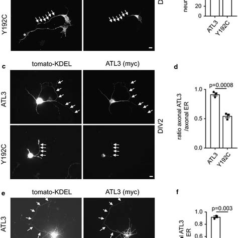 Atl3 Y192c Induced Er Morphology Changes And Malformation Of The