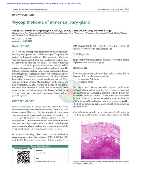 Pdf Myoepithelioma Of Minor Salivary Gland
