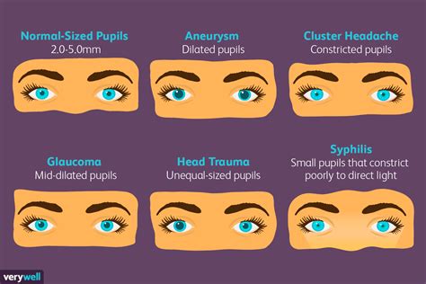 Printable Pupil Size Chart Pupils Are In Charge Of How Much Light Goes