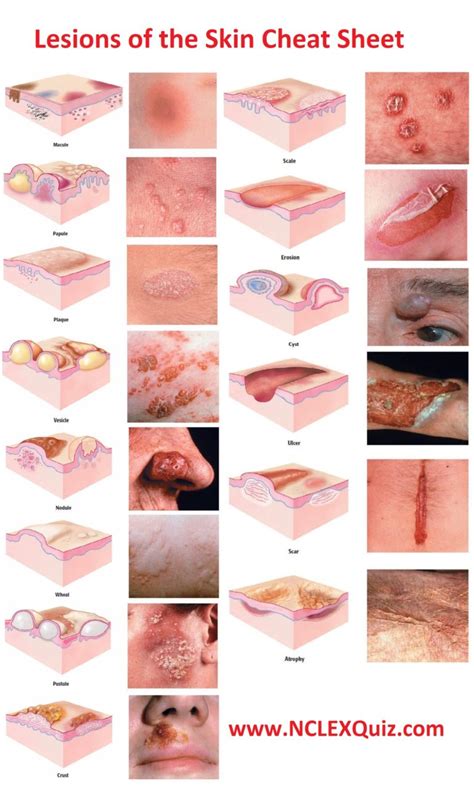 dermatology terminology of skin lesions