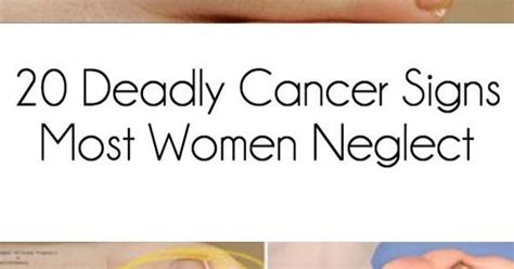 20 Deadly Cancer Symptoms Most Women Ignore Medicine Health Life