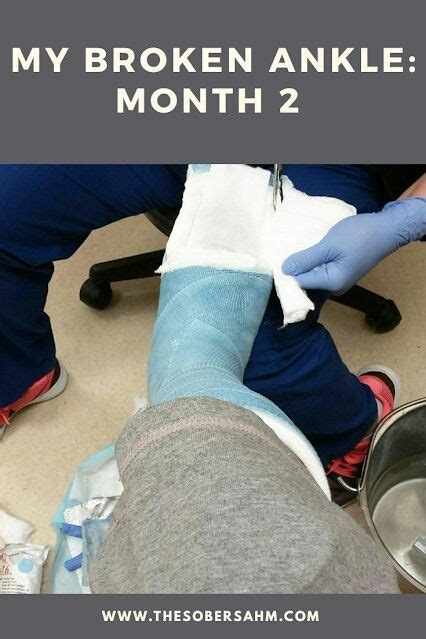 My Broken Ankle Month 2 Broken Ankle Broken Ankle Recovery Ankle