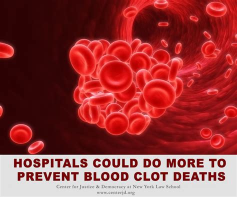 Spotlight Hospitals Could Do More To Prevent Blood Clot