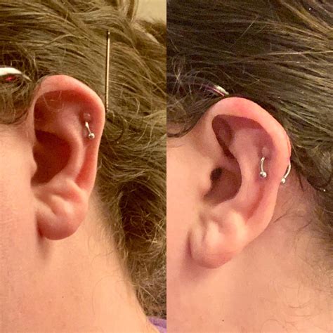 Constant Keloids And 10 Months Healing For Helix Rpiercing